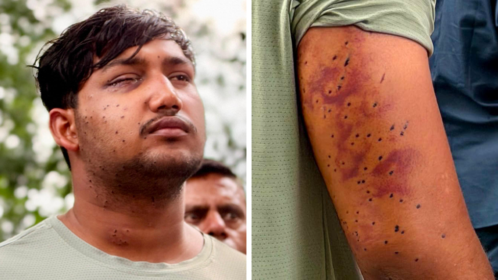 Pellet Gun Fire? Independent Experts Confirm Wounds from Delhi Protest