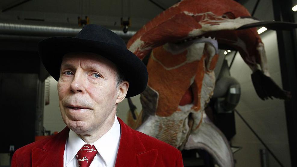 Gunther von Hagens Dies at 81—Pioneer of Plastination and Body Worlds Faces Final Legacy